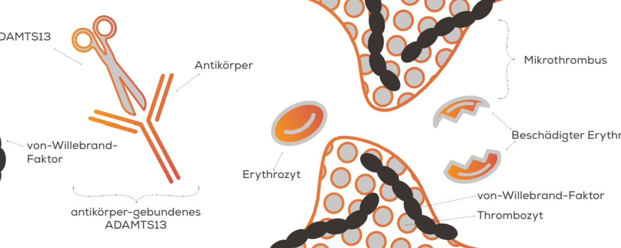 aTTP: Faktenblatt zu Häufigkeit, Symptomen und Ursachen